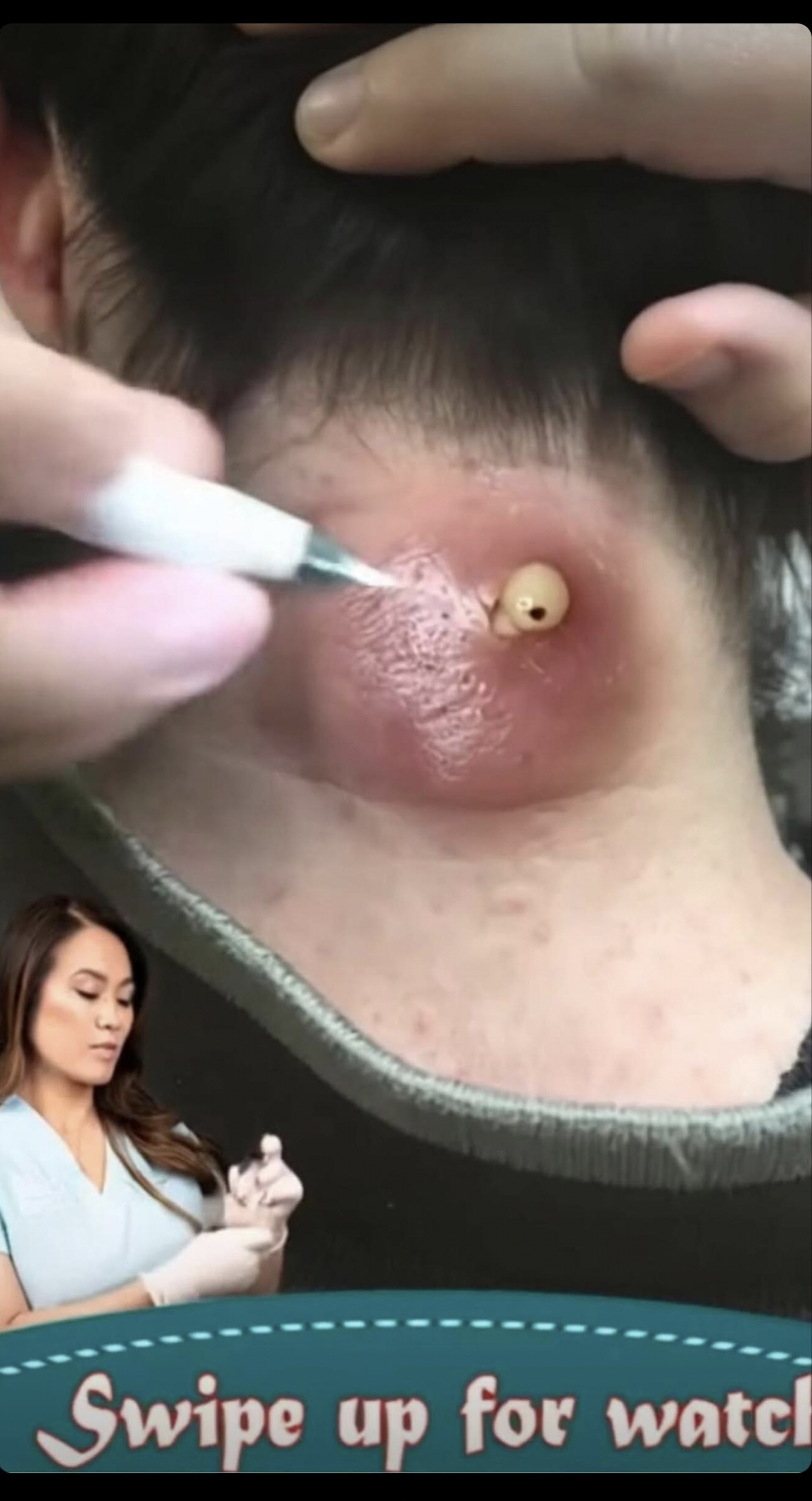 Seven Things That Clog Your Pores And Cause Acne